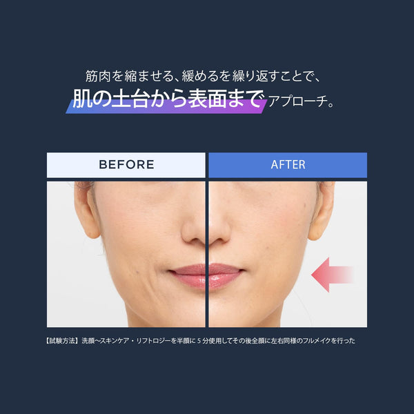 【Pre-Order】YA-MAN Liftlogy SP EMS Facial Lifting Device – Limited Edition Pink (YJFD2PSKAM)