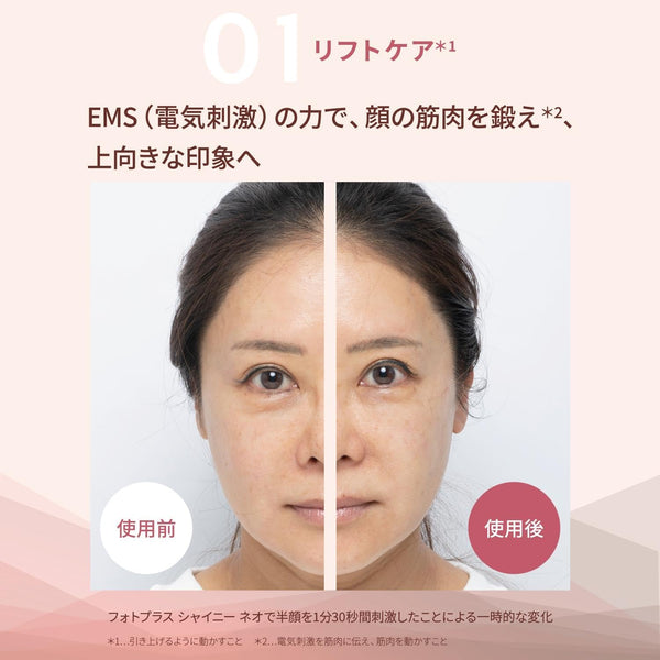 Ya-man PhotoPlus Shiny Neo Lift RF & EMS Facial Device