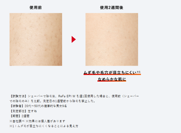 ReFa EPI W Hair Removal Device
