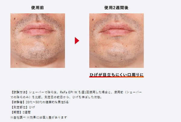 ReFa EPI W Hair Removal Device