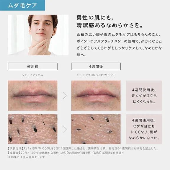ReFa EPI W COOL Hair Removal Device