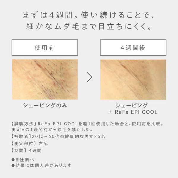 ReFa EPI COOL Hair Removal Device